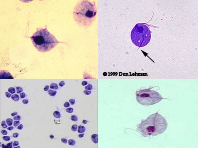 trichomonas vaginalis локализация паразита в организме человека trichomonas vaginalis локализация паразита в организме человека