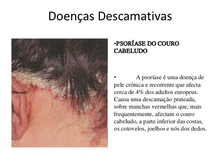 Como usar o óleo de cabelo de laranja