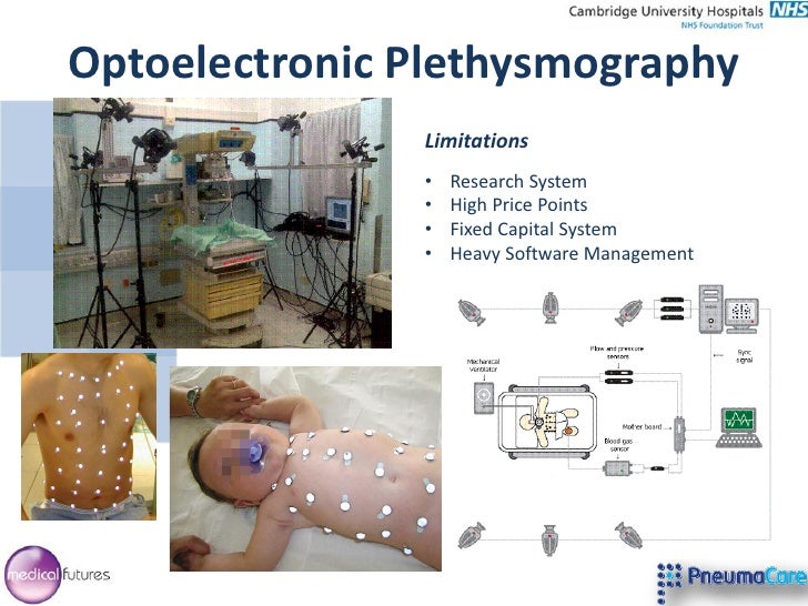 Structured Light Plethysmography