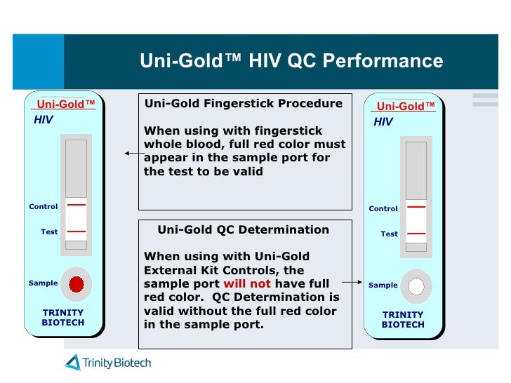 Trinity Uni Gold Hiv Presentation For Tx