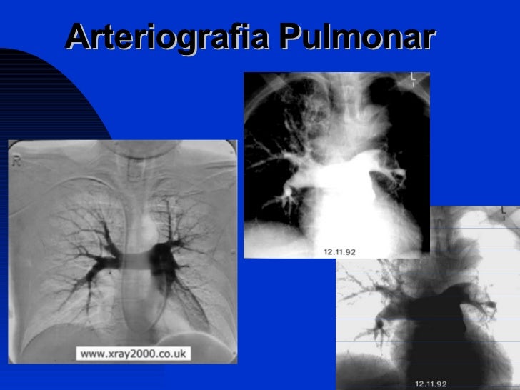 Exame de arteriografia