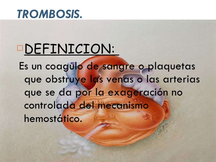 La ampliación varicosa de la vena del labio sexual