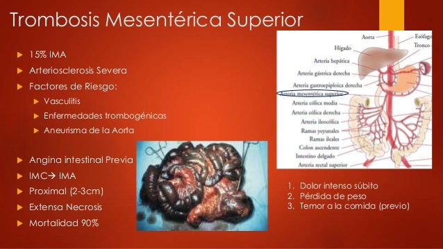 El tratamiento de la tromboflebitis de las venas profundas en el pie