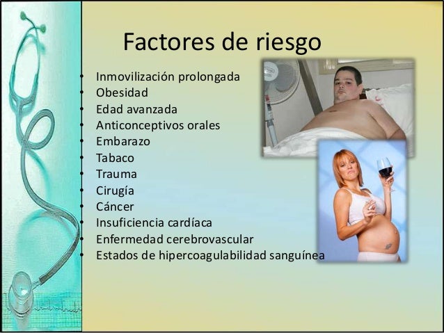 Varikoz después de contraceptivo