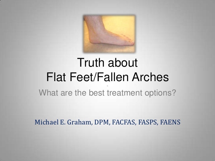 Adult Acquired Flat Feet