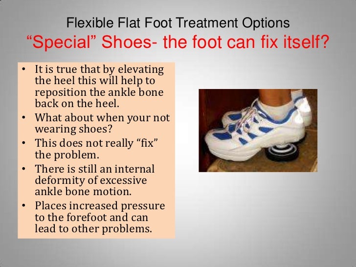 flat foot treatment shoes flat treatment options flat foot treatment shoes flat treatment options