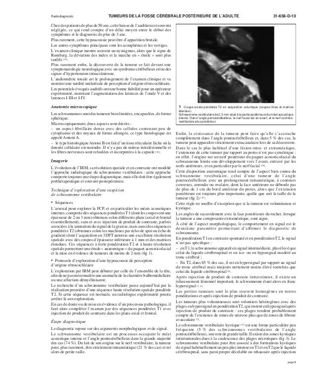 Tumeur Fosse postérieure Symptomes