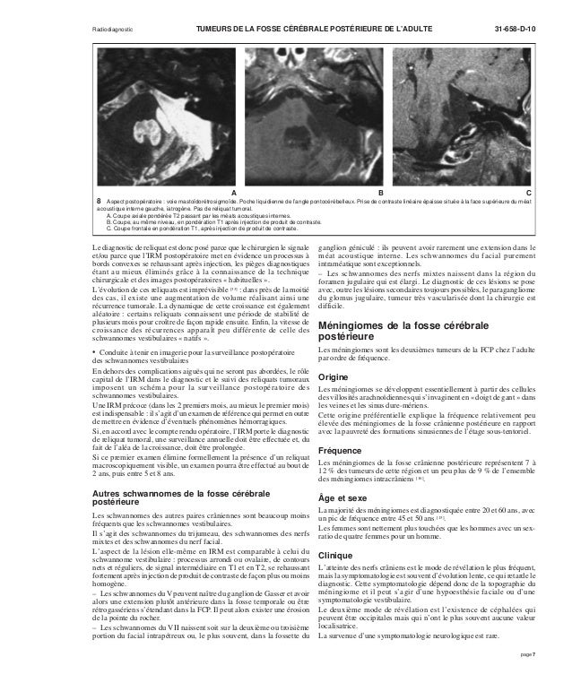 Tumeur Cérébrale Frontale