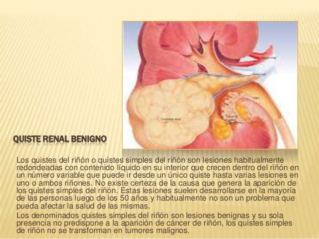 Los puntos en el cuerpo para el tratamiento de la osteocondrosis