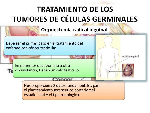 tesla model s occasion kaufen