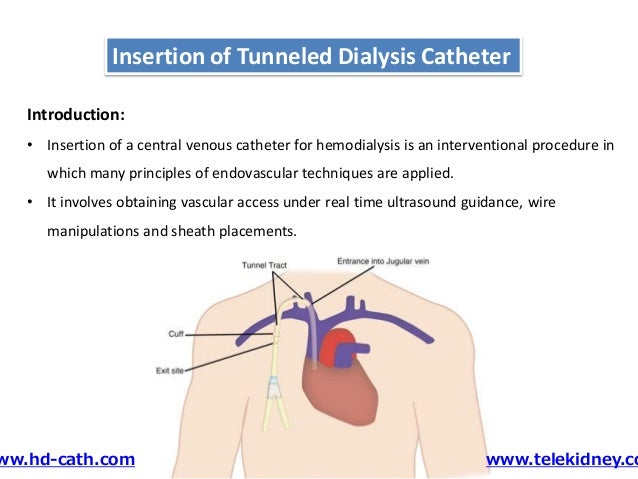 Hemodialysis website online