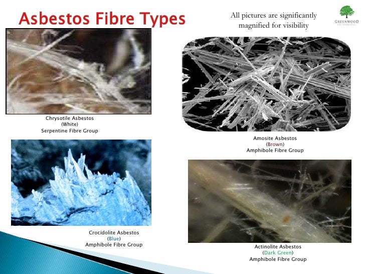 Lung most cancers screening asbestos exposure biggest mesothelioma agreement