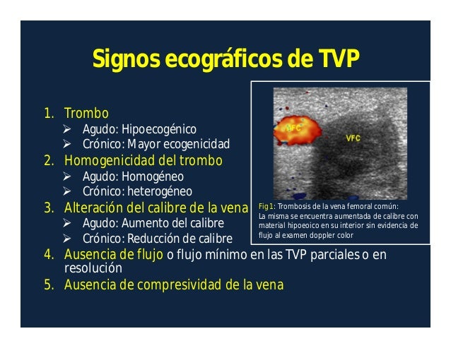 Como aumentará el miembro viril vidio el ejercicio