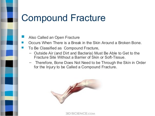 open vs closed fracture open vs closed fracture