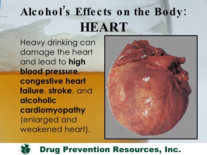 stroke symptoms quizlet tpa stroke calculator