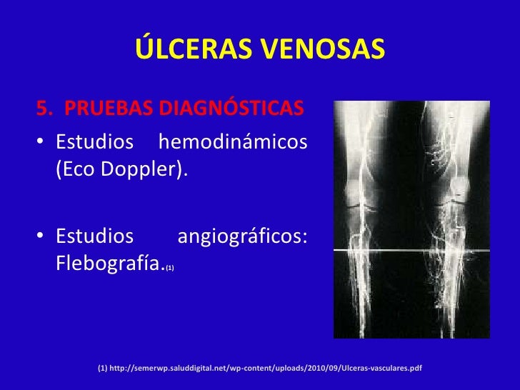 Que untar varikoz las vaginas
