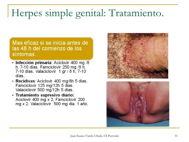 Fotos verrugas genitales hombres mujeres 4 Fotos verrugas genitales hombres mujeres 54