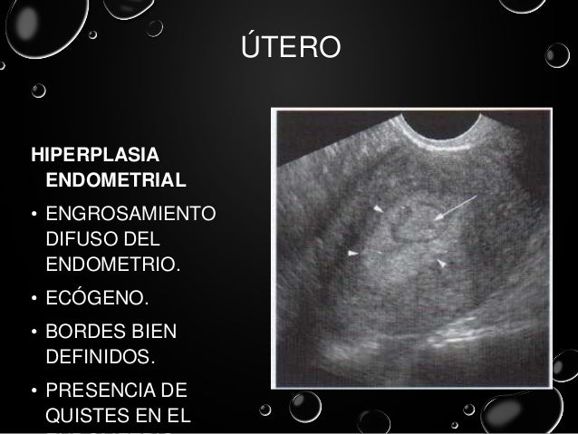 Ultrasonido pelvico Ultrasonido pelvico