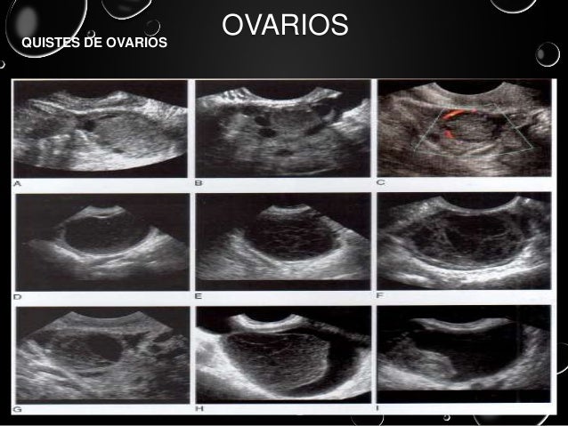 types of contractions muscle