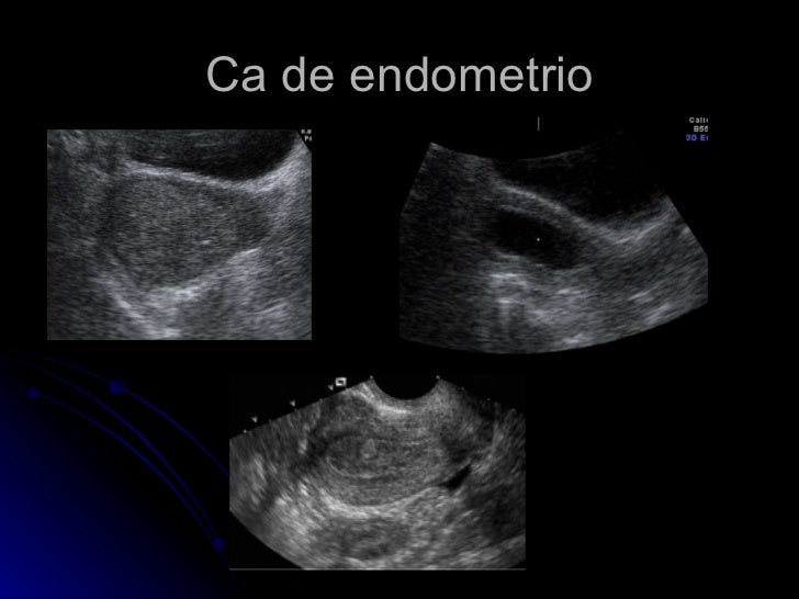 Ultrasonido pélvico