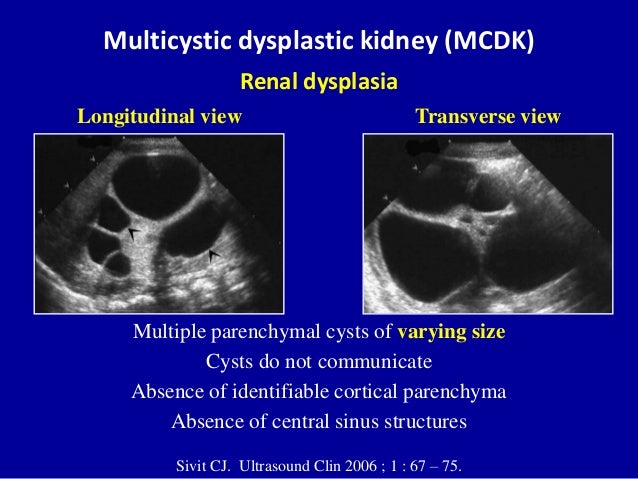 peritoneal dialysis tips