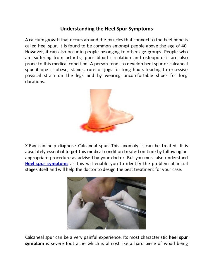 Understanding heel spur symptoms1