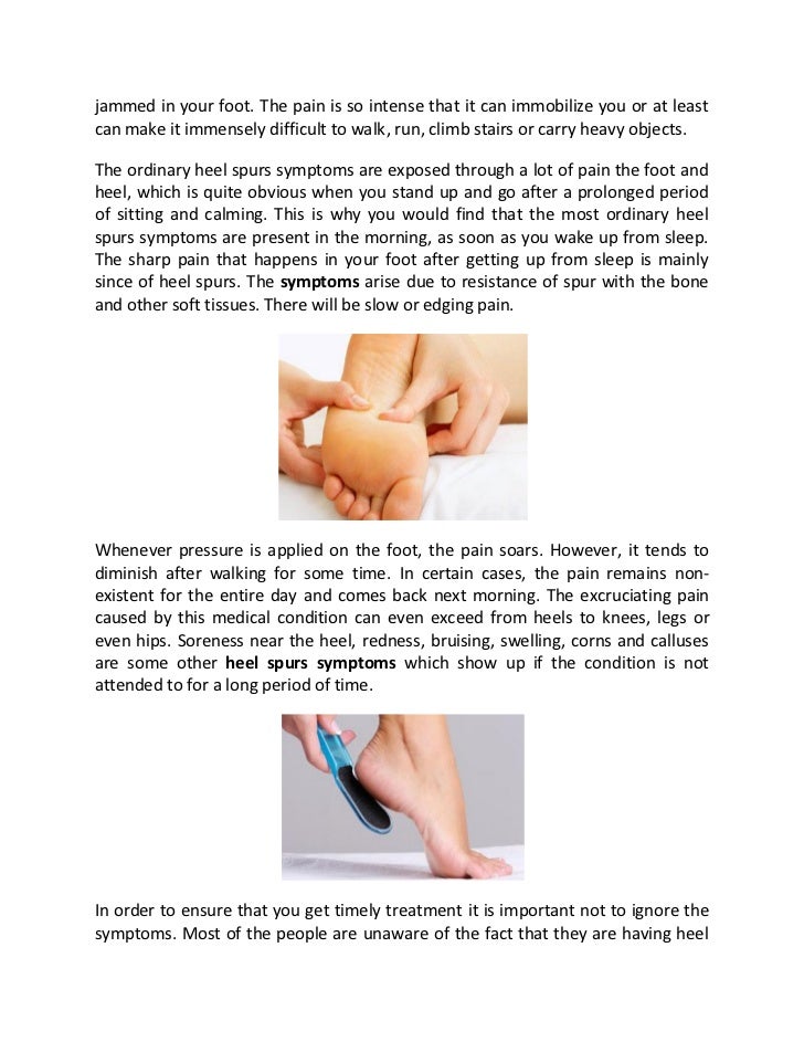 Understanding heel spur symptoms1