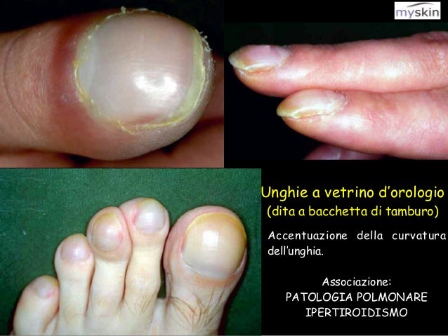 Eczema di una parte pelosa della testa di bambini di una fotografia