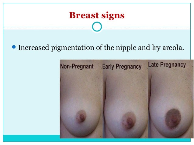 Pregnant Nipple Photos 43