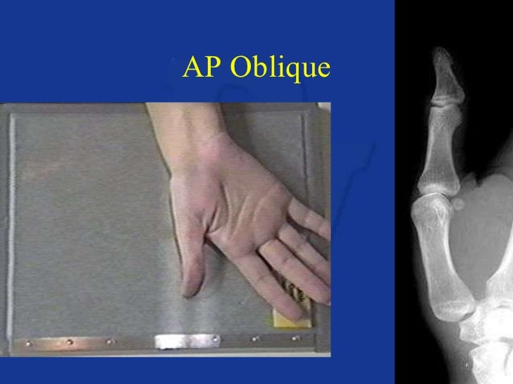 Upper extremity anatomy & positioning