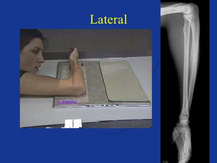 Upper extremity anatomy & positioning