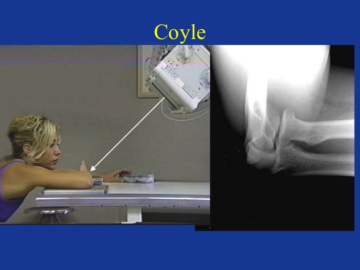 Upper extremity anatomy & positioning