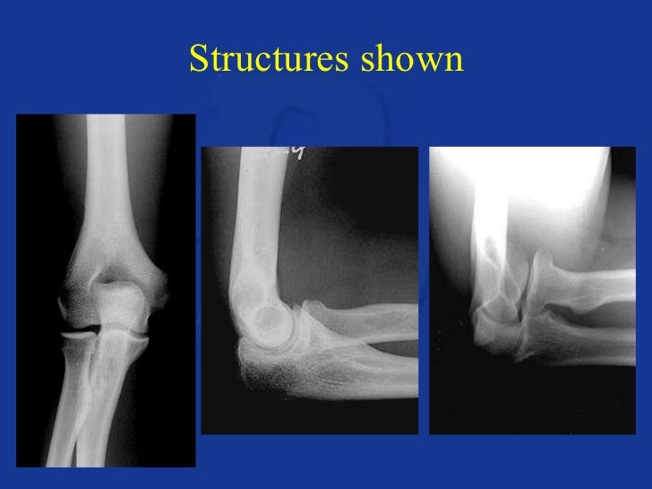 Upper extremity anatomy & positioning