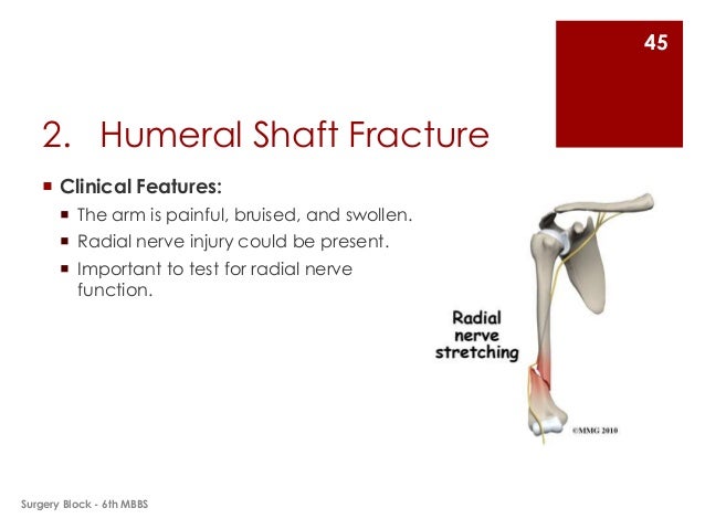 Fractures and Dislocations of Upper Limb