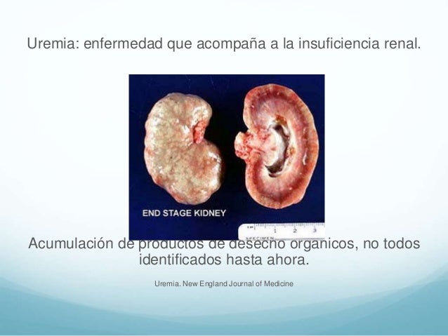 Uremia Uremia