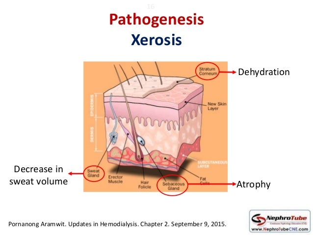 dialysis middle gainesville fl dialysis hd