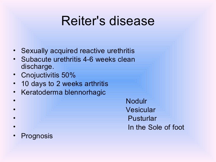 urology.Urethral strictures.(dr.ismaeel)