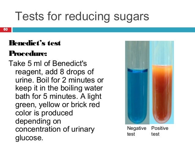 1 find amount reducing sugars and starch yelloe and green 1find the amount of reducing sugars and starch in yelloe and green bananas by using the benedict's test nad iodine test why the benedict's solution should be used in excess. 1 find amount reducing sugars and starch yelloe and green 1find the amount of reducing sugars and starch in yelloe and green bananas by using the benedict's test nad iodine test why the benedict's solution should be used in excess.