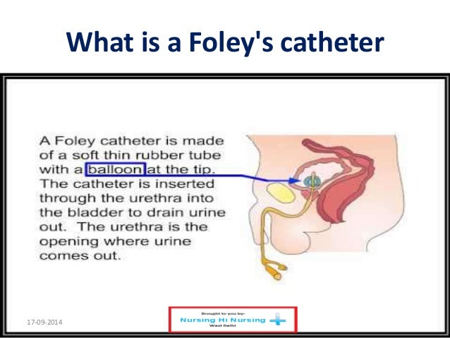 Bladder filling catheter