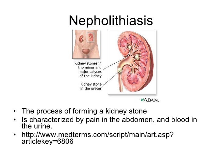 Disease Urinary System Disease Urinary System