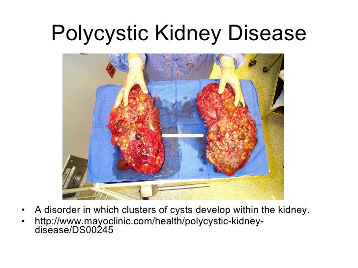 Urinary system essay