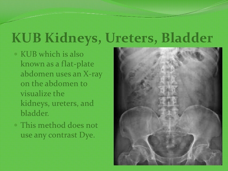 Urinary system presentation9