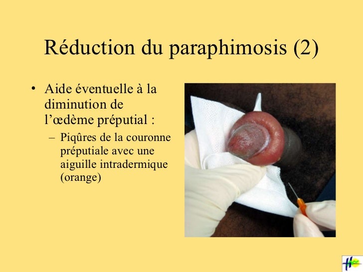 Urogyn pedia 2 rm 12 04 11