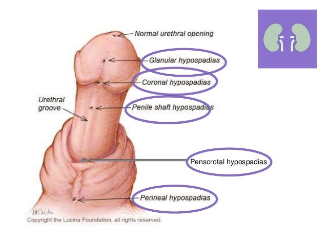 How to enlarge your penis without oil