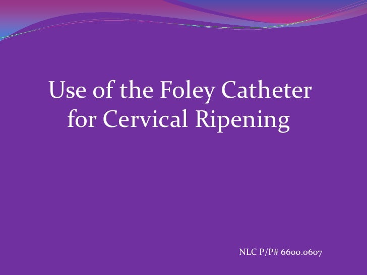 Use of foley catheter for cervical ripening