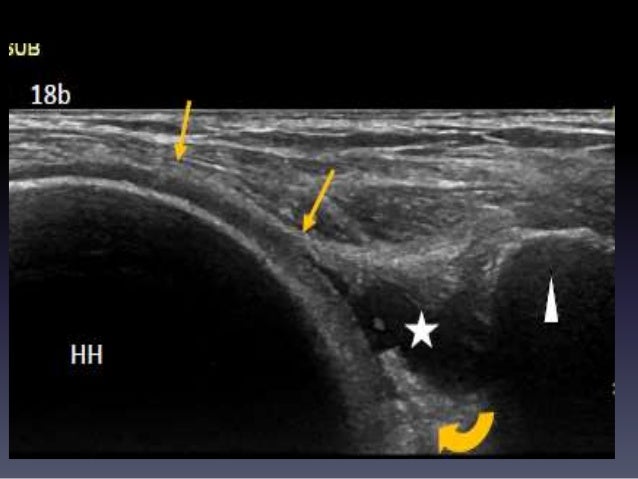 Ultrasound shoulder and knee joints
