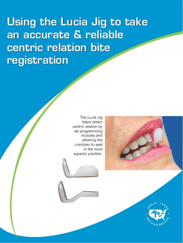 Using the lucia jig for accurate bite s220