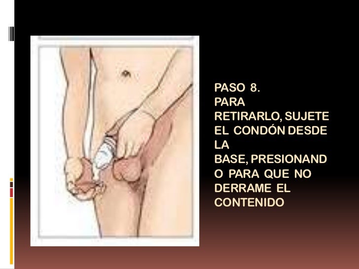 El miembro en el estado inexcitado muy pequeño