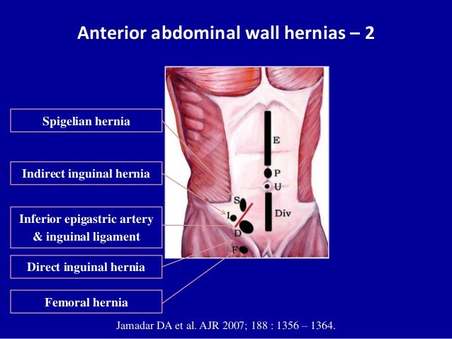 Ultrasound of the abdominal wall hernias