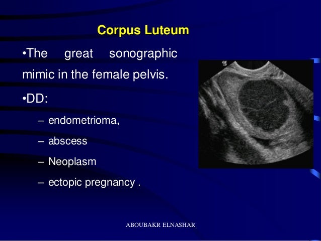 Ultrasonography of the ovary